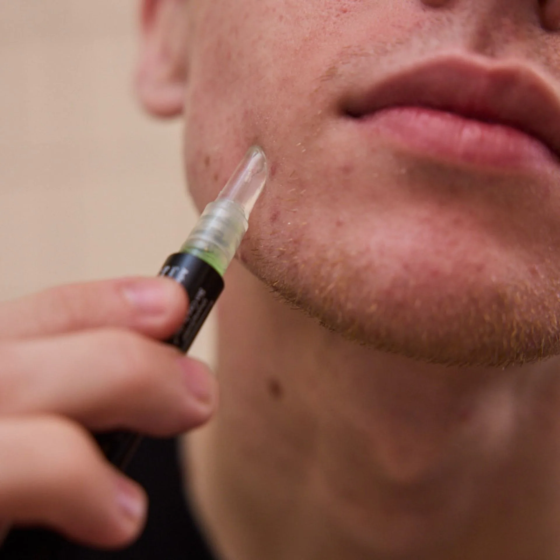 ACNE GEL PEN - Image 4
