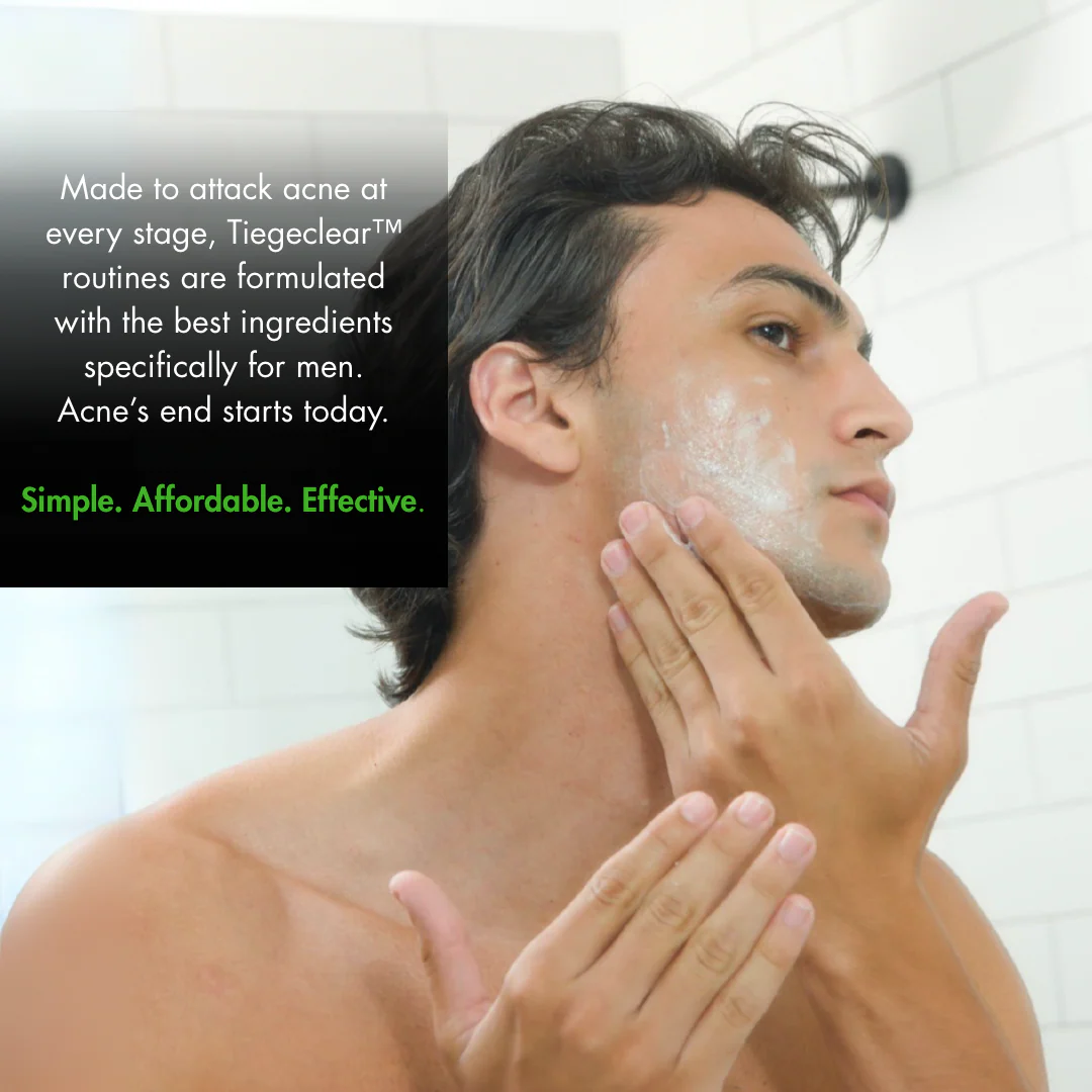 Level 1: The TiegeClear® ACNE Essentials Routine - Image 4