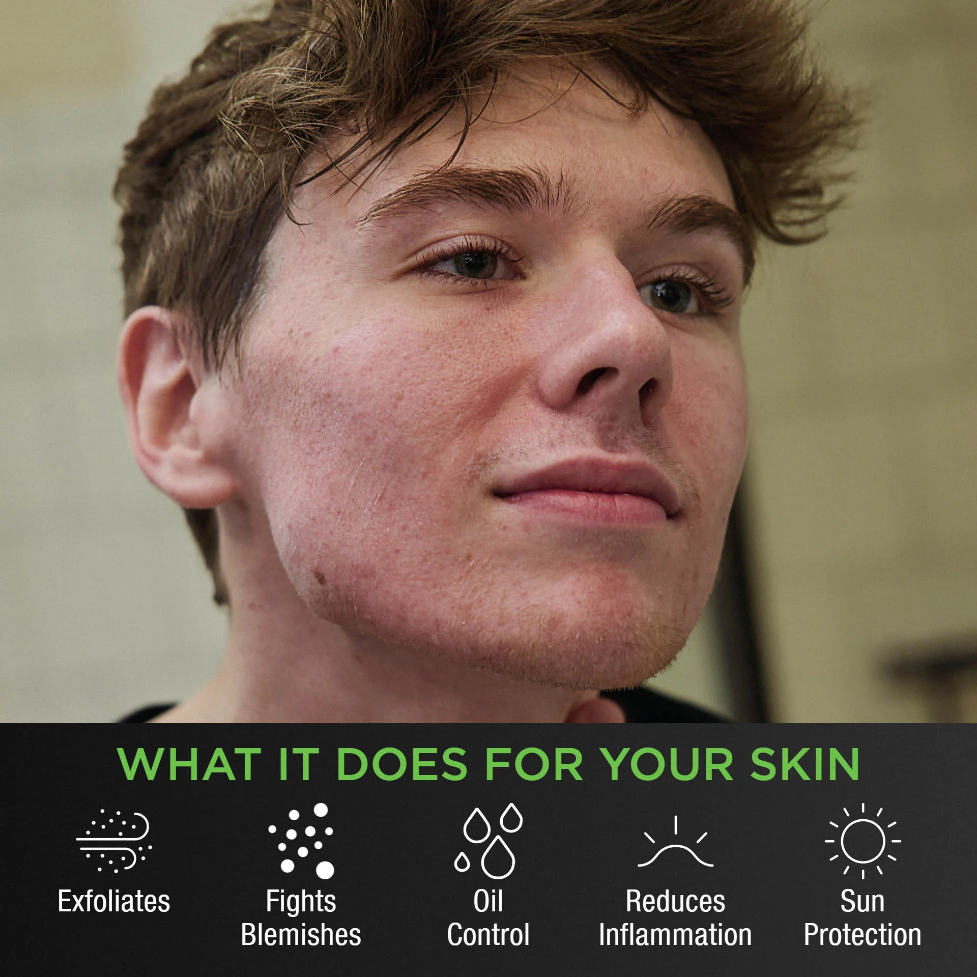 Level 2: The TiegeClear® ACNE Advanced Routine - Image 4